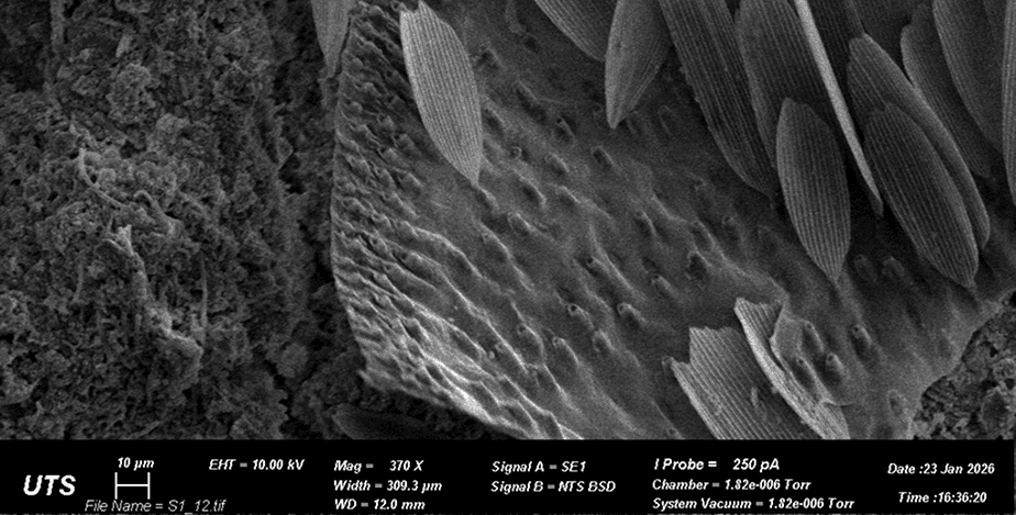 scanning-electron-micrograph